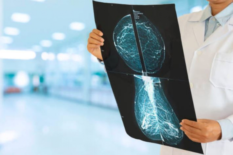Curso de Atualização em Mamografia Preço Vila Augusta - Curso de Especialização em Mamografia e Densitometria óssea