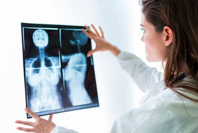Curso de Atualização em Mamografia Vila Machado - Curso Técnico de Especialização em Mamografia