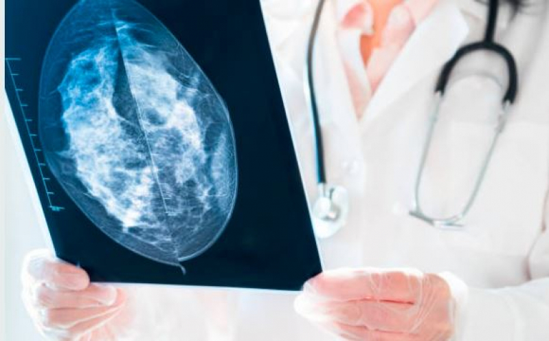 Curso de Capacitação em Mamografia São Matheus - Curso de Extensão em Mamografia