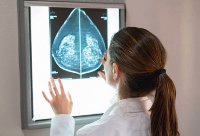 Curso de Especialização em Mamografia e Densitometria óssea Preço Aeroporto - Curso de Capacitação em Mamografia