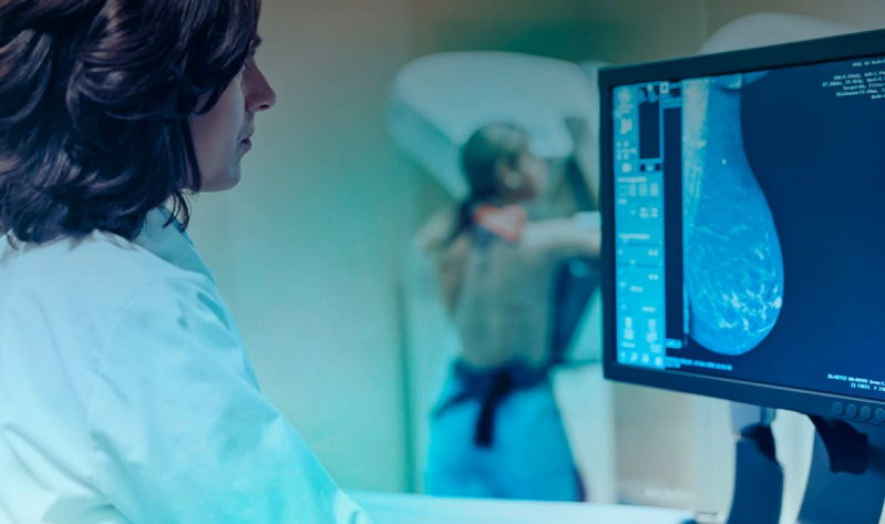 Curso de Especialização Técnica em Mamografia Tatuapé - Curso Técnico em Radiologia Especialização em Mamografia