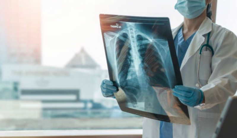Curso Técnico de Radiologia Médica Valores Cidade Tiradentes - Curso Técnico em Radiologia Médica