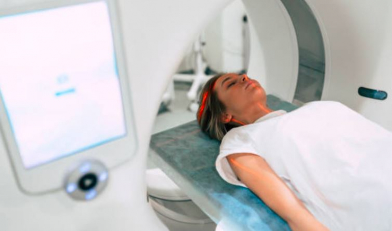 Preço de Curso de Especialização em Radiologia Tomografia Aeroporto - Curso de Especialização em Tomografia Guarulhos