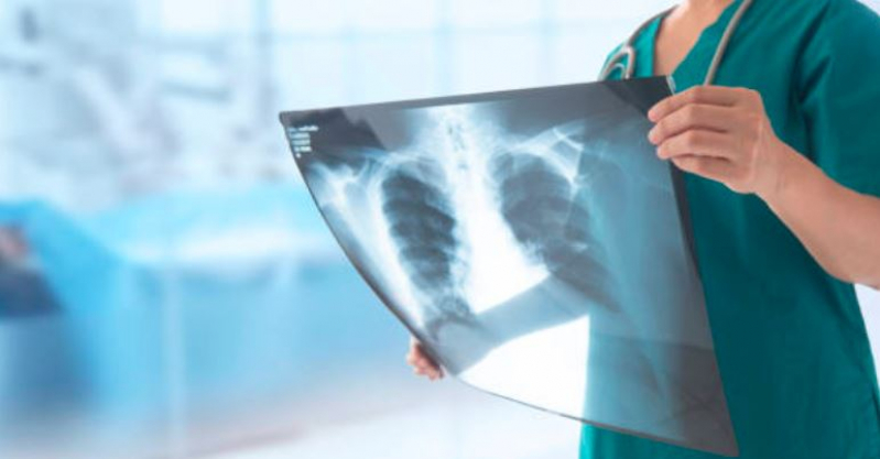 Qual o Preço de Curso Técnico de Radiologia Presencial Tremembé - Curso Técnico em Radiologia Médica