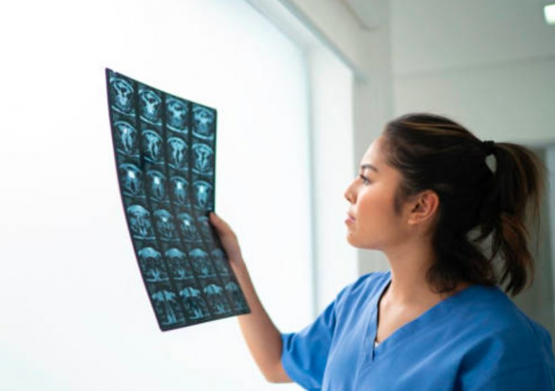 Qual o Preço de Curso Técnico em Tomografia Zona Norte - Curso Técnico de Radiologia