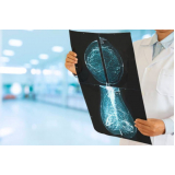 curso de atualização em mamografia preço Bonssucesso