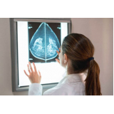 curso de especialização em mamografia e densitometria óssea preço Parque Cecap