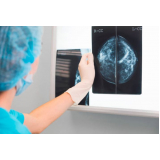 Curso de Atualização em Mamografia
