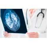 Curso de Especialização em Mamografia para Técnico em Radiologia