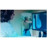 Curso de Especialização Técnica em Mamografia