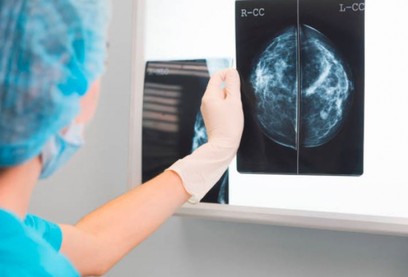 Valor de Curso de Atualização em Mamografia Itaquera - Curso de Especialização em Mamografia para Técnico em Radiologia