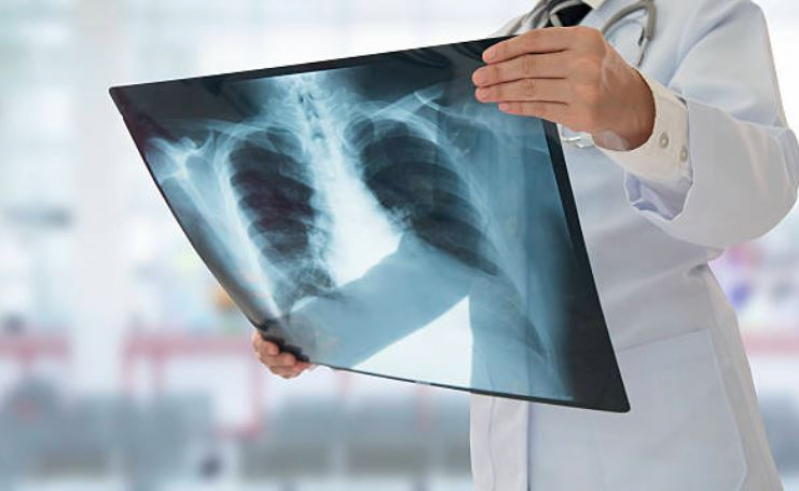 Valor de Curso Técnico de Radiologia Presencial Mooca - Curso Técnico em Radiologia Médica